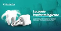 implantologia-w-dental-pro-gdynia-pogorze